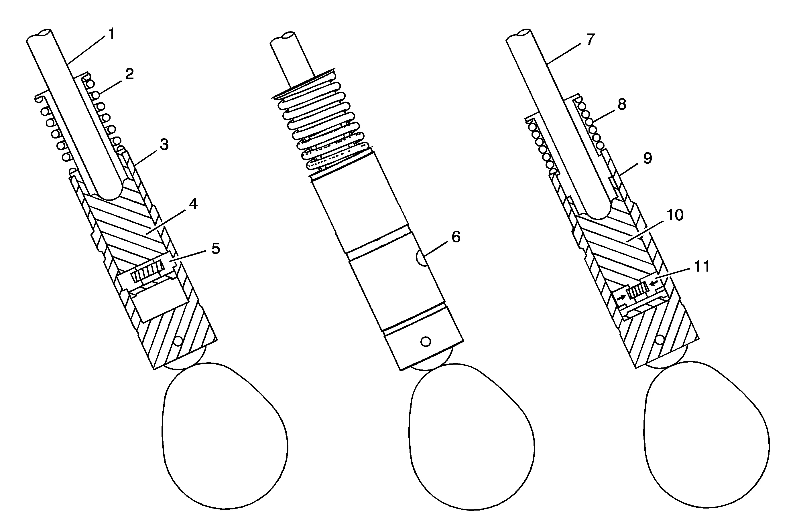 Cylinder Deactivation (Dynamic Fuel Management) System Description (L84, L87) — figure 2